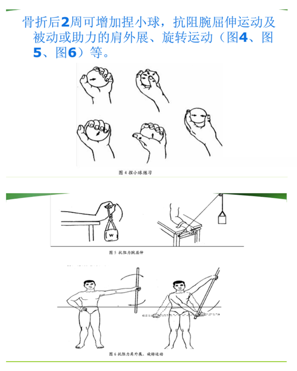 锁骨骨折术后该怎么锻炼,现骨科专家为大家详细解读:      功能锻炼方