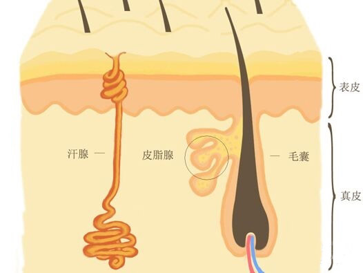 痤疮是怎么来的?(有图有真相)
