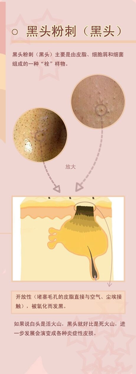 ͷҪƤ֬,ϸмϸɵһ