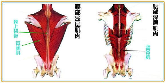 怎样预防腰肌劳损复发