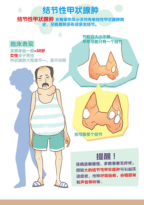 结节性甲状腺肿,强制补碘盐的恶果?!