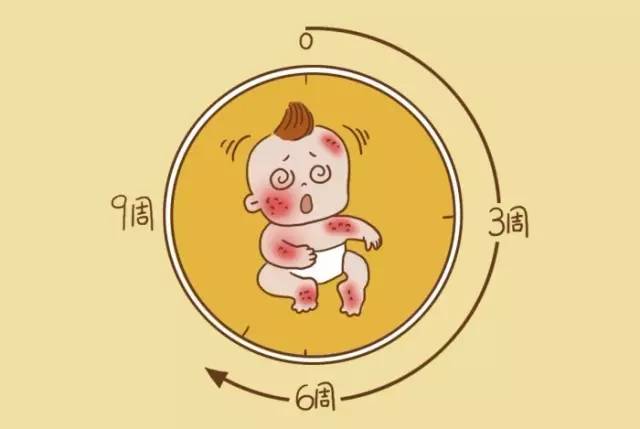 【漫画版】小儿荨麻疹咋办?